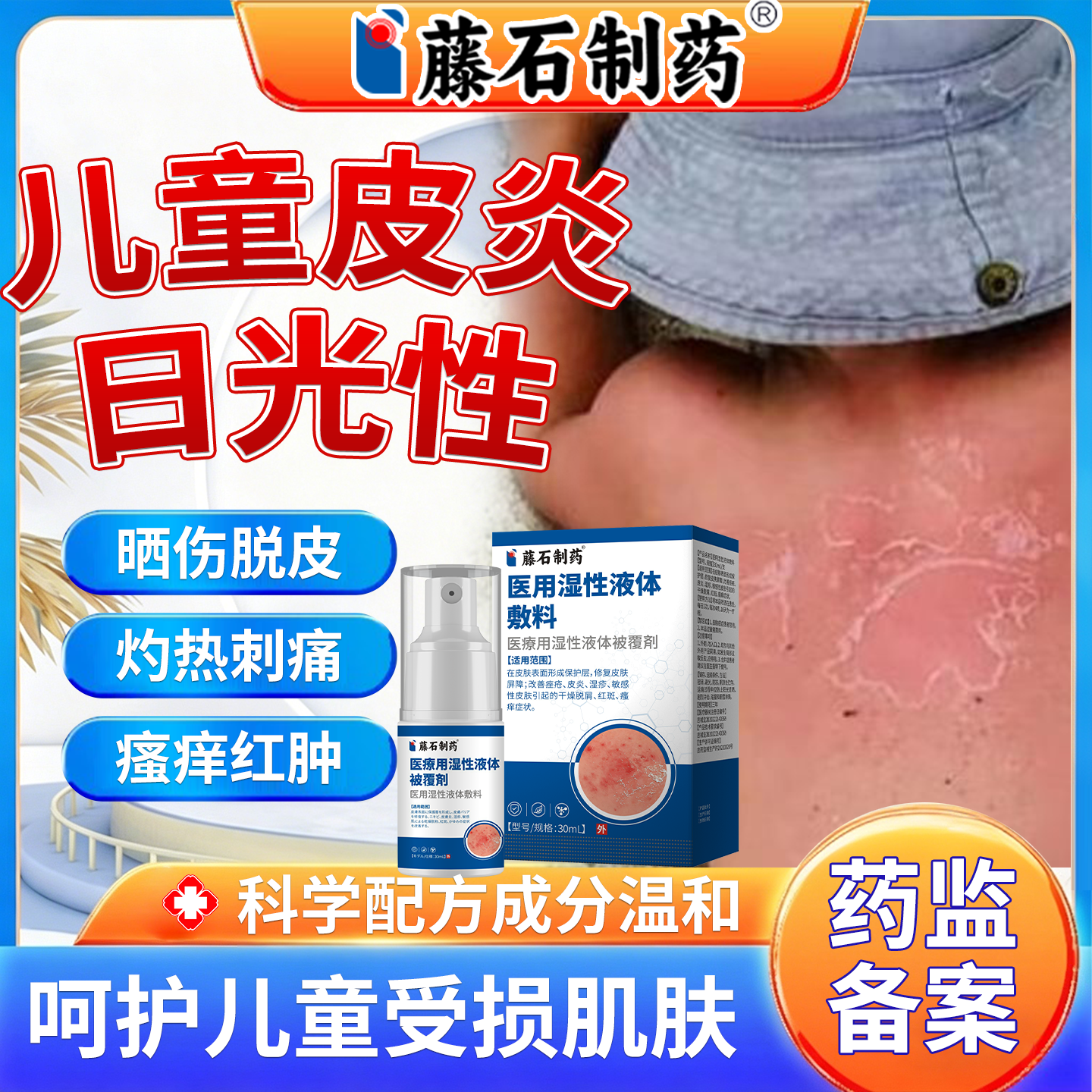 儿童日光性皮炎皮肤太阳晒伤紫外线过敏红肿瘙痒止痒修复喷雾剂OM