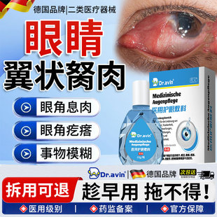 去眼睛胬肉眼角长翼状胬肉眼模糊除有异物感可搭滴眼液眼药水OM
