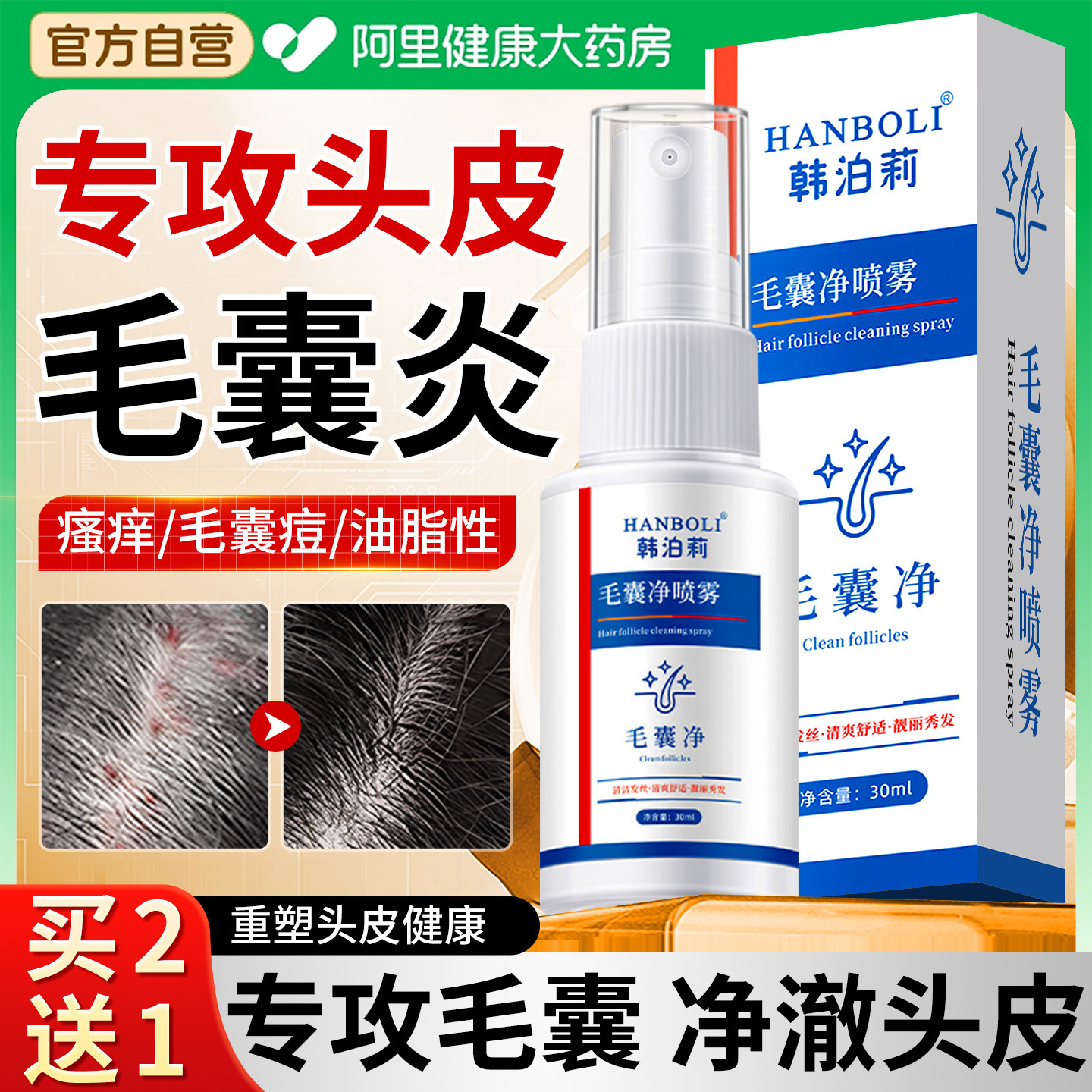 毛囊炎头部用头皮上专长痘痘膏特止痒菌效溢脂性净喷雾剂非洗发水