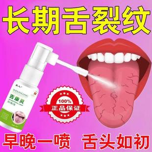 舌头裂痕地图舌裂纹舌齿痕灼口综合症舌头发白发厚麻木起泡抑菌液