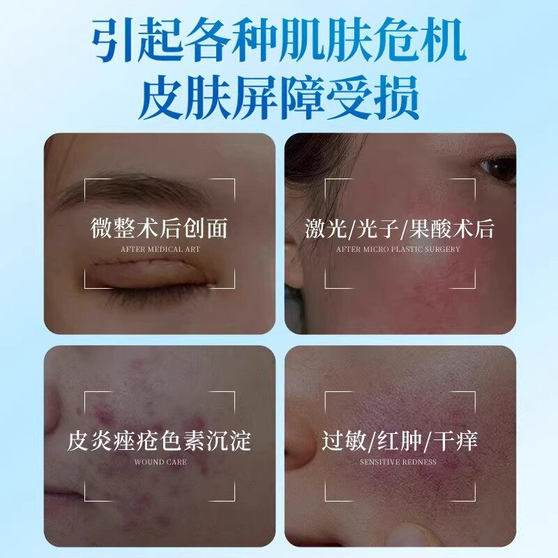 Recombinant Collagen Repair Dressing Medical Grade - Product image 2
