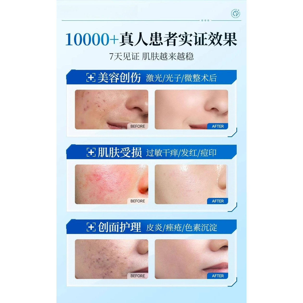 Recombinant Collagen Repair Dressing Medical Grade - Product image 4