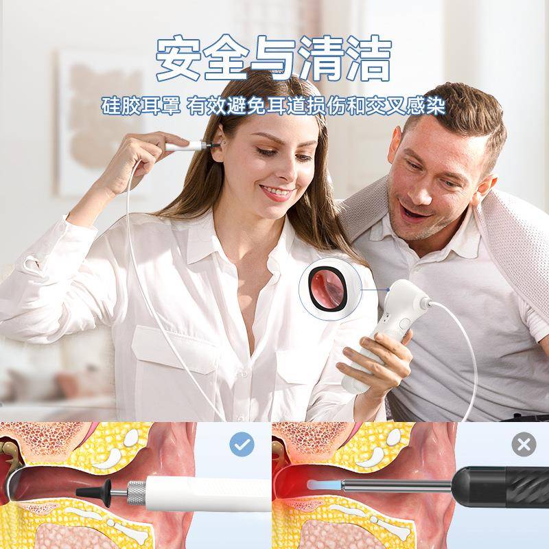 源头货源S能160智高清手握式耳镜家用便耳捷可视检查仪10SYC0万A