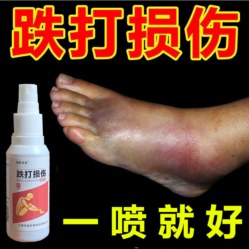 速发跌打损伤喷剂消肿止痛膝盖韧带血伤骨折活拉化瘀脚肉扭伤肌踝