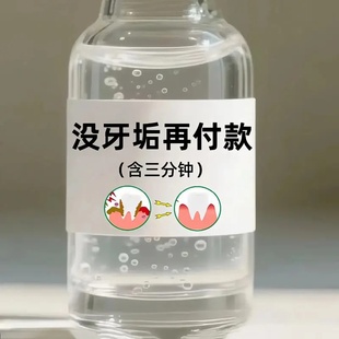 牙石溶解漱口水洗牙齿污垢牙垢牙黄牙渍清理神器