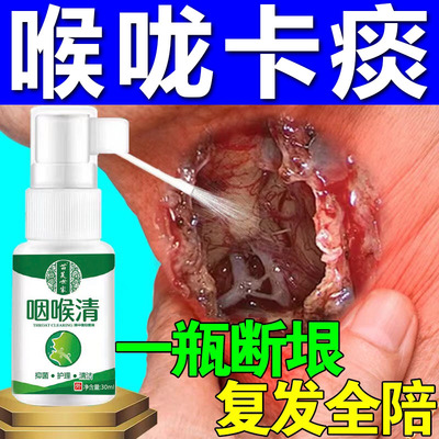 痰多吐不完粘嗓子不舒服老有痰喉咙干痒咳嗽肿痛治疗白痰粘稠喷剂