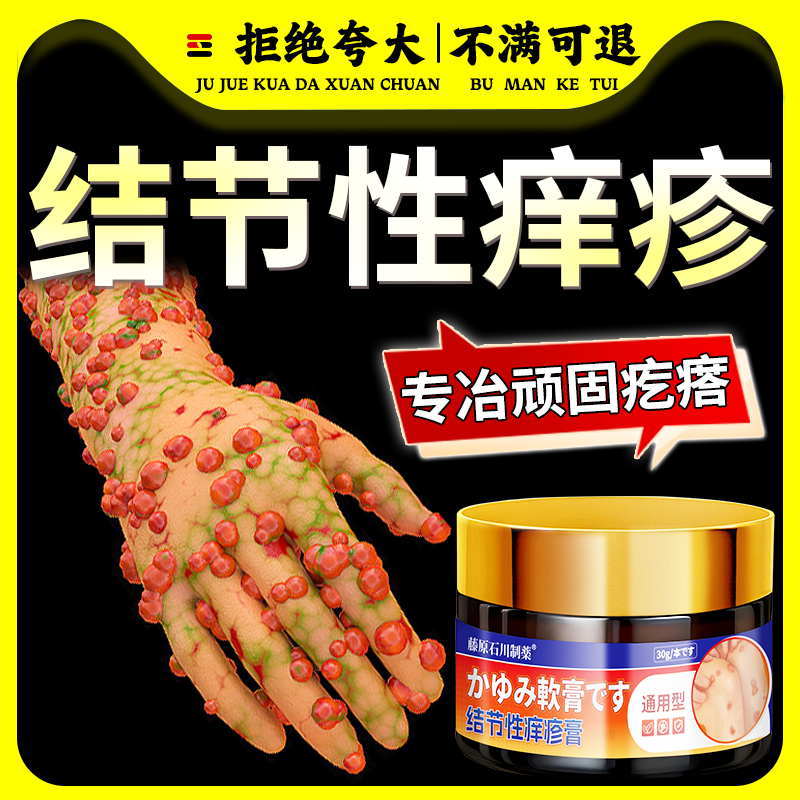 结节性痒疹否特效否治顽固硬疙瘩皮肤瘙痒否止痒抑菌否药膏红斑痒