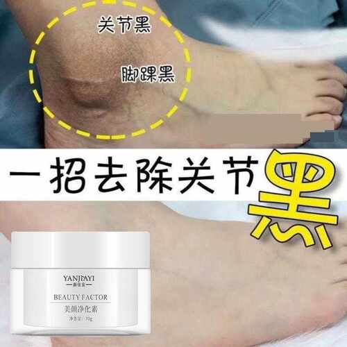屈臣氏关节去黑膝盖胳膊手肘去黑磨砂膏屁股腋下黑色素去死皮神器