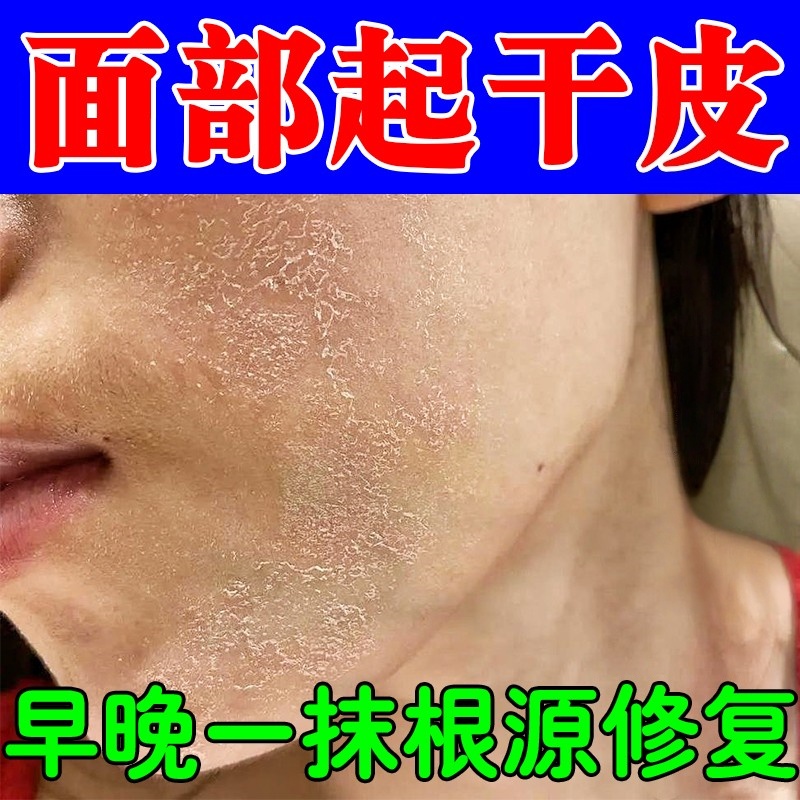 脸起皮干燥有碎屑换季脸爆皮脸上长干皮真菌感染痒疼面部粗糙掉皮