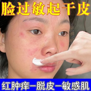 皮肤修复脸部外用脸上干燥起皮泛红发痒起小疙瘩痘专用软膏