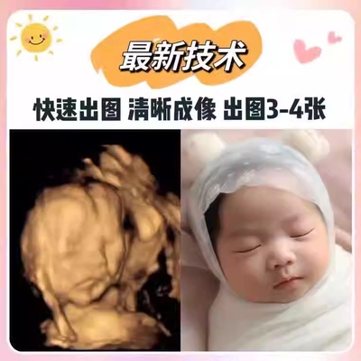 宝宝四维AI照片ai预测宝宝彩超照片四维AI照片胎儿预测长相生成像
