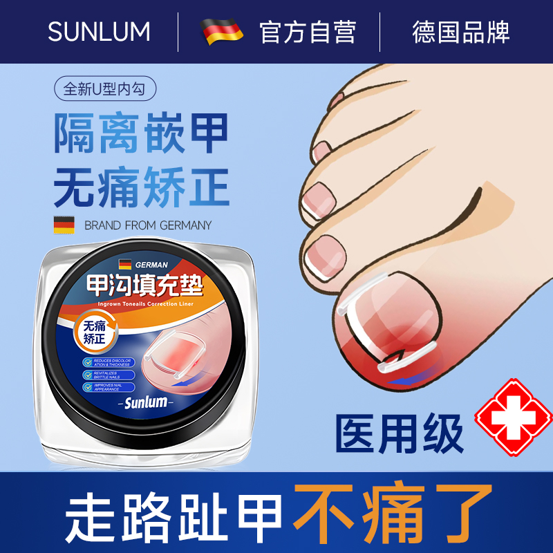 速发甲沟矫正神器甲指甲嵌甲隔离填充垫片脚趾甲里肉往长纠正炎贴