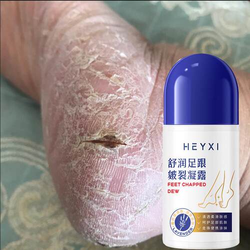 2瓶装【氏推荐 一夜嫩滑脚后跟】有效修护防干 干裂手脚可用按摩