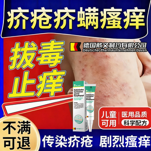 疥疮结节皮肤瘙痒外用大腿内侧疥虫疥螨治疗干疮的膏阴囊止痒RW