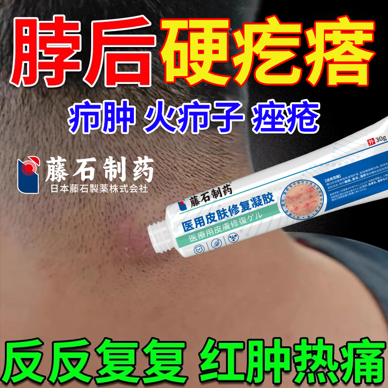 后脖颈长疙瘩泛红脓包药监备案膏