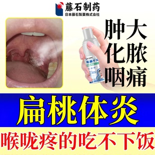急性化脓性扁桃体炎喷雾喷剂咽喉咙肿痛溃疡儿童嗓子肿大化脓RW