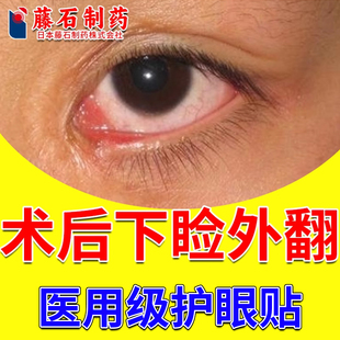 眼袋术后下眼睑外翻下垂肌无力医用眼贴搭眼皮松弛麻痹提拉神器RW