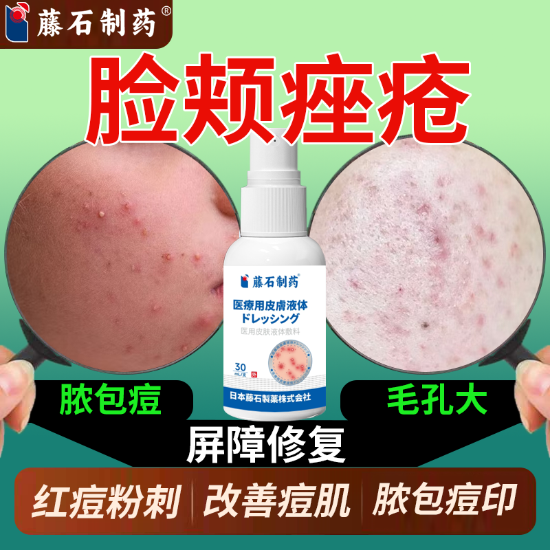 脸颊两侧长痘痤疮毛孔粗大有痘印痘坑脓包痘重度祛痘毛囊炎粉刺Q8