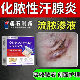 腋下红肿流脓化脓性汗腺炎反复不愈肿块疼痛吸收脓液渗液医用级RW