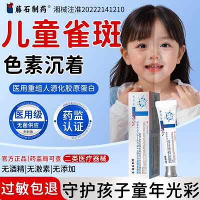 儿童祛斑霜雀斑脸部青少年祛除儿童雀斑专用膏医用型淡化黑色素RW
