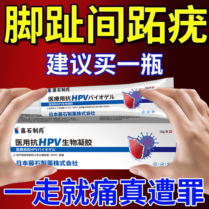 脚趾间跖疣脚底脚上有疣鸡眼肉刺石疣趾去除猴子足部老茧净零膏RW