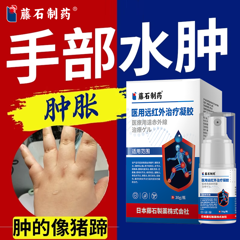 术后淋巴手水肿利去浮肿手指肿胀麻木消肿尿水肿胀肿痛消喷雾排RW