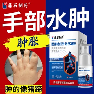 术后淋巴手水肿利去浮肿手指肿胀麻木消肿尿水肿胀肿痛消喷雾排RW