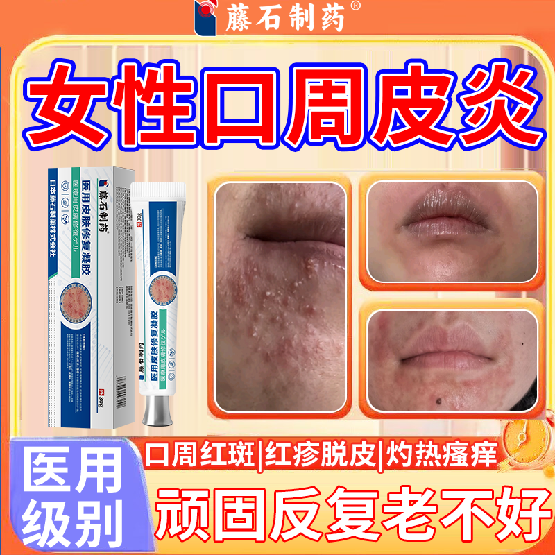 藤石制药口周皮炎专嘴巴周围红疹红斑痒用膏嘴角干燥起皮医用RW