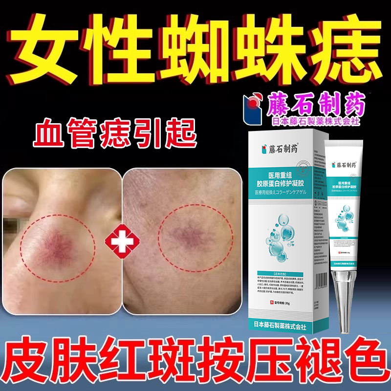 点女性脸上面部蜘蛛痣去除身上脖子血管痣瘤红色斑樱桃膏红血丝RW