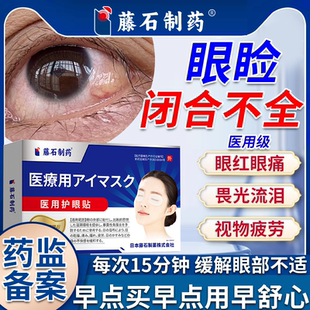 眼睑闭合不全眼贴冷敷眼睛红肿疼痛闭眼贴畏光干眼症眼睑外翻RW