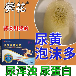 尿蛋白尿浑浊尿黄有异味泡沫多不容散肾病男士肾阳虚泡脚包温肾RW