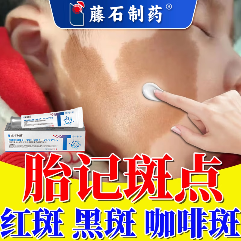 胎记除红斑黑斑咖啡斑褐斑遮盖遮瑕去膏淡化神器太田痣黑色素祛RW