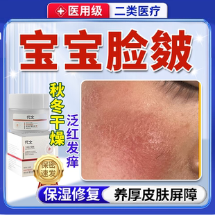 秋冬季节宝宝脸颊皴泛红干燥修复屏障受损面膜袪红敏感肌面霜乳Q8