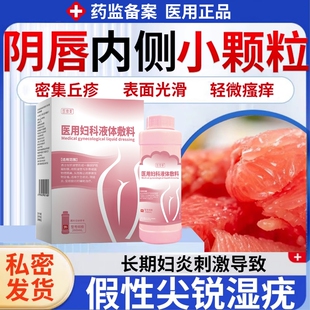 私处假性湿疣尖锐湿疣妇炎止痒阴唇内侧小颗粒丘疹水疱药监备案RW