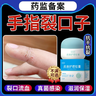 手指裂口子干裂贴脱皮修复霜保护套真菌感染滋润保湿起硬皮皲裂RW