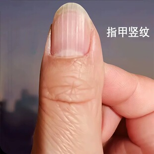 指甲竖纹修复液指甲受损开裂凹凸不平空甲分离甲肉分层甲床短小药