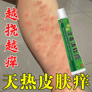 夏天皮肤发痒热小腿痒全身痒长疙瘩出汗湿疹干燥起皮红疹修复乳膏