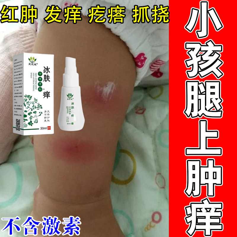 孩子身上起红疙瘩蚊虫叮咬臭虫咬伤红肿起大包发痒抓挠植物喷剂