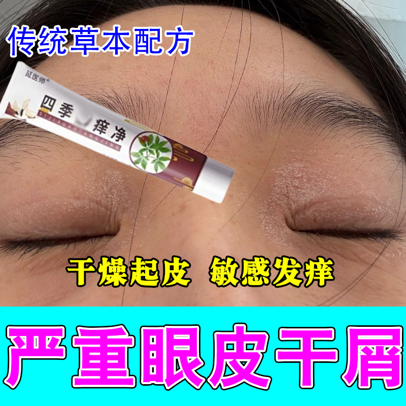 眼皮红肿干起皮痒眼睛周围发痒神经性角干燥起皮掉皮修护舒缓膏