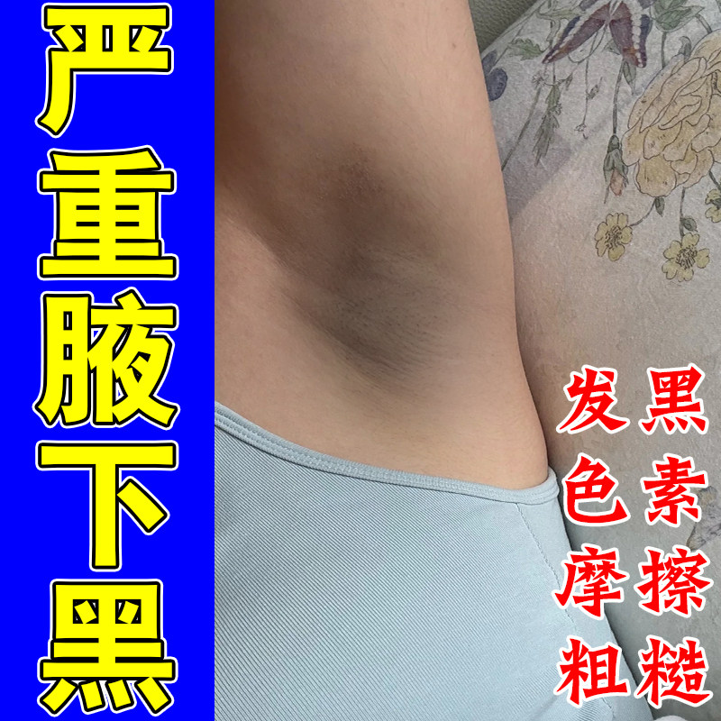 腋下肤色深腋窝粗糙暗沉胳肢窝老废角质堆积腋下褶皱发黑嫩按摩膏