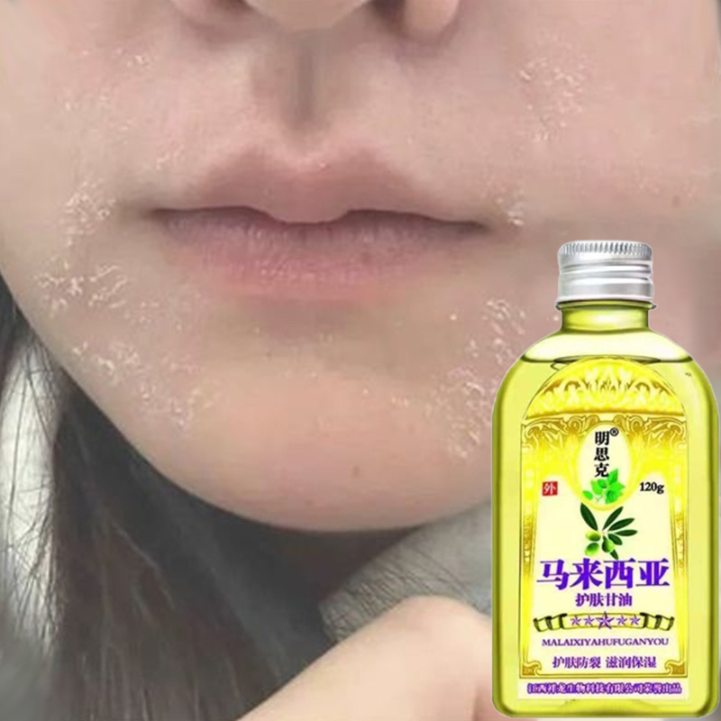 嘴周掉屑脸部干燥起皮掉皮屑秋冬脸部掉皮爆皮发痒皮肤粗糙起干皮