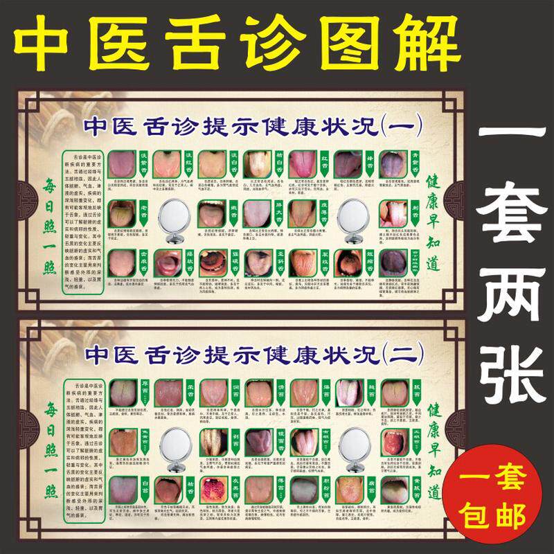 中医舌诊完全图解图谱美容院海报挂图养生图片宣传墙画装饰广告