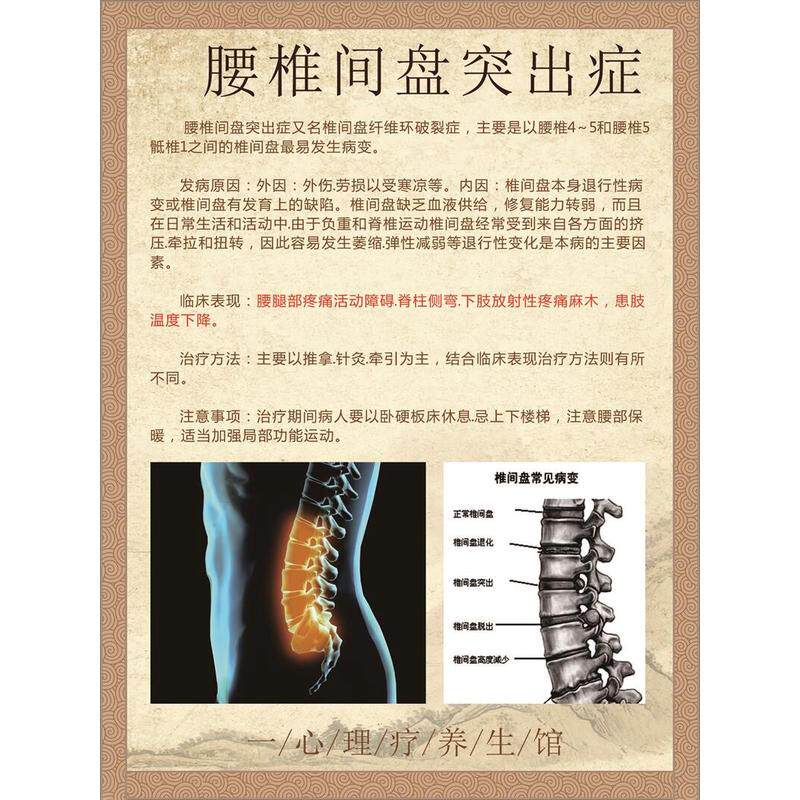 腰椎间盘突出症海报颈椎病颈椎病功能锻炼颈椎病临床特点及治疗