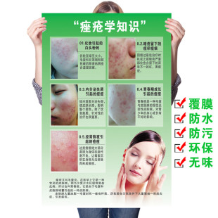 青春痘产生的原因痘痘类型治疗皮肤面部色斑痤疮示意图美容院挂图