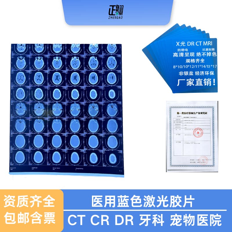 医用蓝色激光胶片 医用干式胶片 ct cr dr核磁胶片牙科胃镜胶片