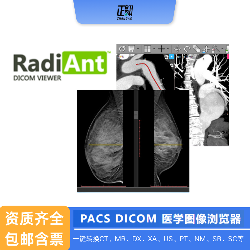 RadiAnt DICOM VIewer 2024中文版dcm医学ct影像看片软件永久激活