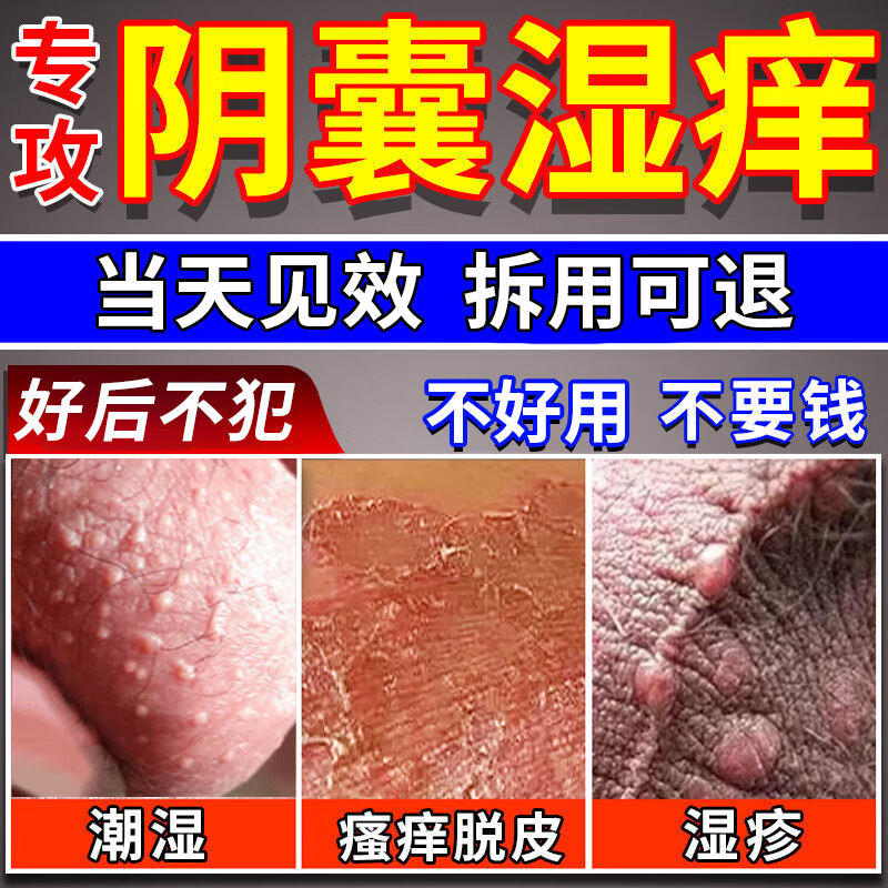 阴囊潮湿瘙痒男性专用膏药