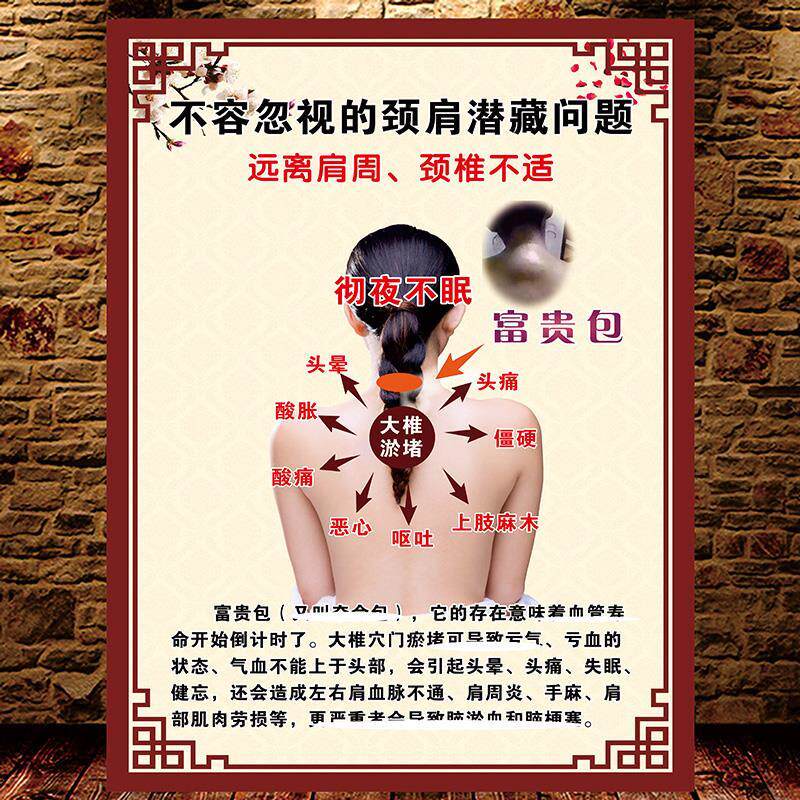 富贵包挂图大椎穴海报颈椎调理广告宣传画墙贴中医养生挂画定制