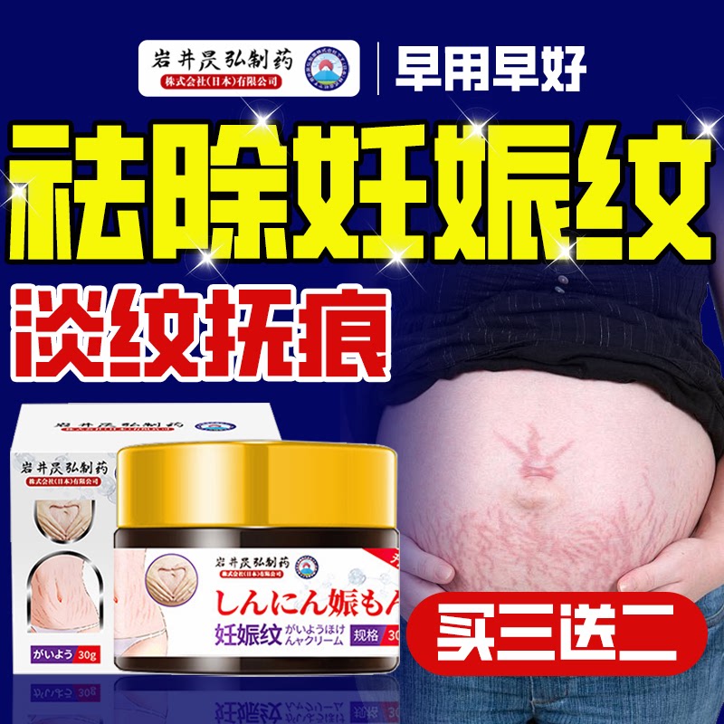 妊娠纹修复膏淡化肥胖纹孕妇产后去消除疤痕妊辰纹紧致肚皮修复霜