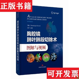 责编 社 现货 高文上海科学技术出版 译者 孔泸晶 多米尼克·戈索特 法 胸腔镜肺叶肺段切除术图解与视频编者 正版